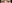 二重まぶた（自然癒着法） — セギム美容外科クリニック