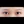 Aegyo-sal filler (under-eye 'love band' / pretarsal roll filler) — before · Pixel Lab Plastic Surgery Clinic