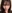 鼻尖形成術（自家軟骨移植） — ハイエンド美容外科クリニック