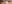 裏ハムラ法（経結膜的眼窩脂肪移動術） — アンド美容外科クリニック