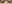 二重まぶた（自然癒着法） — フルルン美容外科クリニック