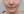 Oligio / Oligio X (โอลิจิโอ) — ก่อนทำ (30วัน) · เยพึนออลกุลคลินิก