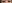 裏ハムラ法（経結膜的眼窩脂肪移動術） — SM美容外科クリニック