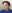 糸リフト（スレッドリフト） — フィッティングウォン