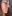 revision rhinoplasty — Luho Plastic Surgery Clinic