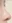 鼻尖形成術（自家軟骨移植） — ルホ美容外科クリニック