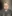 二重あごの脂肪吸引（顎下脂肪吸引） — ディユ美容外科クリニック