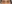 裏ハムラ法（経結膜的眼窩脂肪移動術） — ワンダフル美容外科クリニック