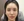 Ultracol (PDO microsphere collagen stimulator injection) — after · Mochi Clinic
