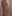 乳房挙上術（バストリフト）＋豊胸術 — バナナ美容外科クリニック