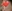 revision rhinoplasty — DM Plastic Surgery Clinic