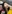Full-face fat grafting (autologous fat transfer) — Mind Plastic Surgery