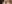 裏ハムラ法（経結膜的眼窩脂肪移動術） — アンド美容外科クリニック