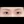 Aegyo-sal filler (under-eye 'love band' / pretarsal roll filler) — before · Pixel Lab Plastic Surgery Clinic