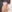 鼻尖形成術（自家軟骨移植） — ベリーグッド美容外科