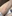白玉点滴 — Sリボンクリニック