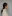 額縮小術（生え際下げ・ヘアライン下降術） — DM美容外科クリニック
