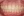 MTA orthodontics (Mini-Tube Appliance partial braces) — after (160days) · Lucent Dental Clinic