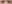 二重まぶた（自然癒着法） — ルホ美容外科クリニック