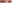 二重まぶた（自然癒着法） — プロミス美容外科クリニック