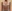 豊胸術（シリコンインプラント／人工乳腺） — バナナ美容外科クリニック