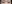 incisional double eyelid surgery — Baba Plastic Surgery Clinic