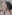 แก้จมูก — คลินิกเสริมความงามชาร์ป (Sharp)