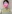 二重あごの脂肪吸引（顎下脂肪吸引） — ディユ美容外科クリニック