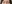 二重まぶた（自然癒着法） — プロミス美容外科クリニック