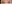 二重まぶた（自然癒着法） — プロミス美容外科クリニック