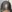 生え際アートメイク（ヘアラインアートメイク） — TOP美容外科クリニック
