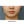Volnewmer (โวลนิวเมอร์ ยกกระชับด้วย RF) — ก่อนทำ (90วัน) · คลินิกศัลยกรรมตกแต่งนาบี