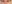 裏ハムラ法（経結膜的眼窩脂肪移動術） — アンド美容外科クリニック