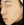 Superficial chemical peel (Korean 'skin scaling') — after (35days) · K-Tox Clinic - Incheon Guwol Branch