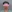 雙下巴抽脂 — Saekim 整形外科診所