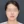two-jaw surgery (bimaxillary orthognathic surgery) — before (90days) · ReFace Dental Hospital