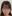 頬骨縮小術（全体／頬骨体部＋頬骨弓の骨切り） — セギム美容外科クリニック