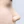 Nasal osteotomy (nasal bone narrowing) — after (7days) · Pop Plastic Surgery Clinic