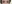 二重まぶた（自然癒着法） — プロミス美容外科クリニック