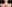 Crooked (deviated) nose rhinoplasty — Coco Line Clinic