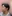 インモードリフト（InMode／FORMA＋MINI FX） — ロリポップ美容外科クリニック
