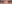 裏ハムラ法（経結膜的眼窩脂肪移動術） — ハッシュ美容外科クリニック