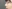 短鼻修正（鼻延長術） — コード美容外科クリニック