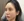 Ultracol (PDO microsphere collagen stimulator injection) — after · Mochi Clinic