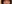 二重まぶた（自然癒着法） — アーバン美容外科クリニック