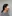 Facelift (rhytidectomy) — DM Plastic Surgery Clinic