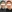 Thread lift — Balance Lab Plastic Surgery