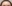 額縮小術（生え際下げ・ヘアライン下降術） — ザフィックス美容外科クリニック
