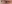 二重まぶた（自然癒着法） — オブジェ美容外科クリニック