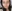Nasal dorsum augmentation with implant (silicone/Gore-Tex) — Uri Plastic Surgery Clinic